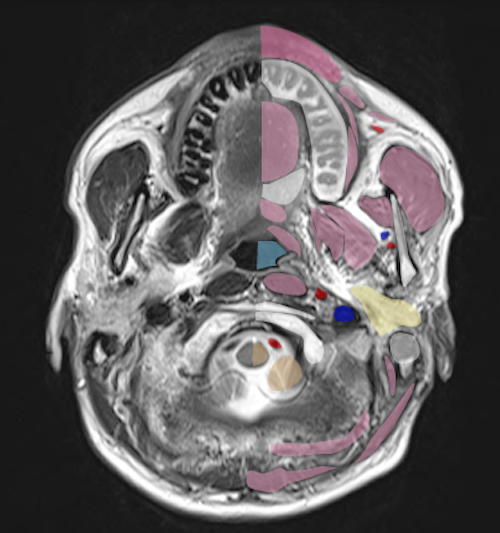 normal anatomy of neck MRI