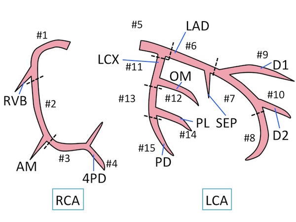 coronal artery anatomy2