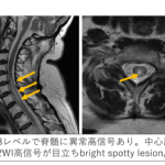脳・脊椎病変の画像診断 脳性まひの診断 | 社会医療法人大道会 ボバース記念病院