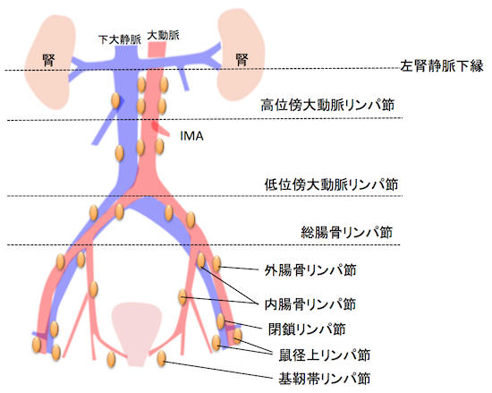 pelvic-lymph-node1