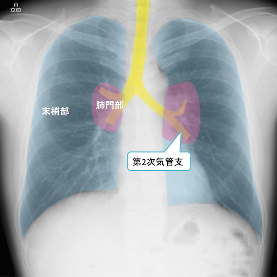 normal anatomy of chest Xray10