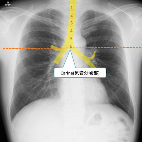 normal anatomy of chest Xray9