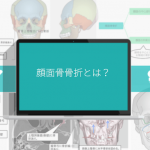 保存版】顔面骨折とは？症状やCT画像診断、治療法を徹底まとめ！
