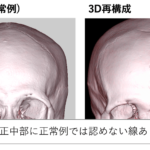 頭蓋骨22分解キット、ナチュラルカラー仕様 A290 | トワテック