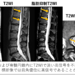 m3電子書籍 | 画像診断 2012年6月号（Vol.32 No.7） おさえて