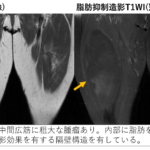 軟部腫瘍のMRI | 青木 隆敏, 青木 隆敏 |本 | 通販 | Amazon