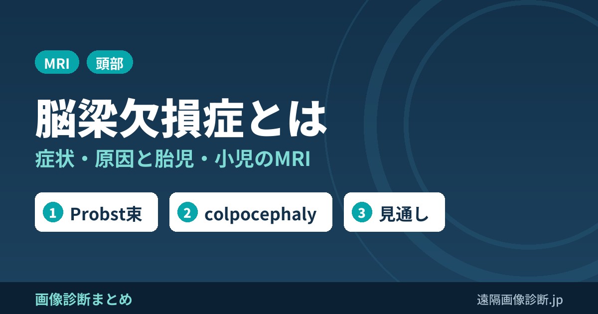 脳梁欠損症とは 症状・原因と胎児・小児のMRI