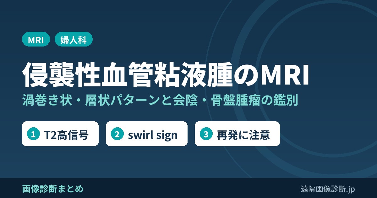 侵襲性血管粘液腫のMRI 渦巻き状・層状パターンと会陰・骨盤腫瘤の鑑別