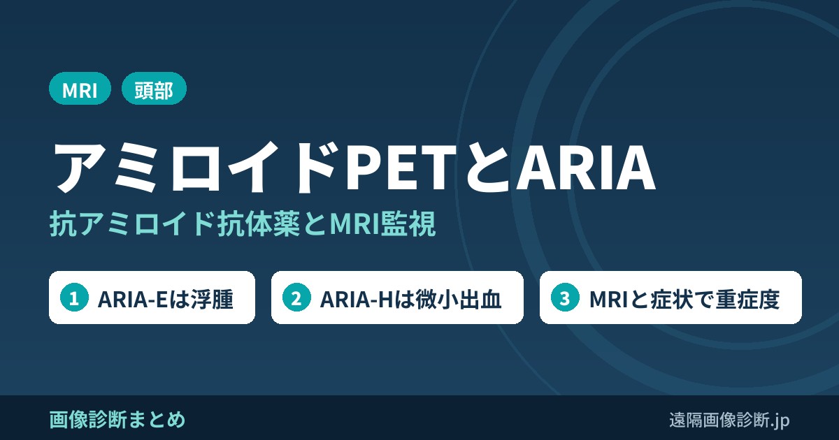 アミロイドPETとARIA 抗アミロイド抗体薬とMRI監視