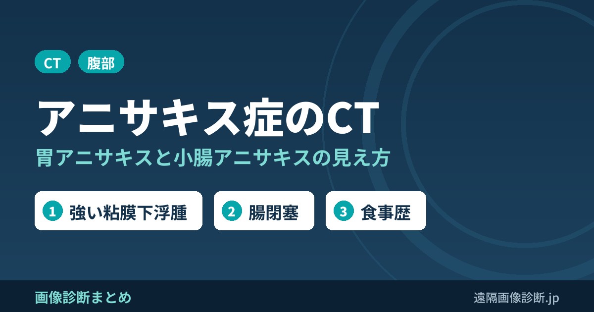 アニサキス症のCT 胃アニサキスと小腸アニサキスの見え方