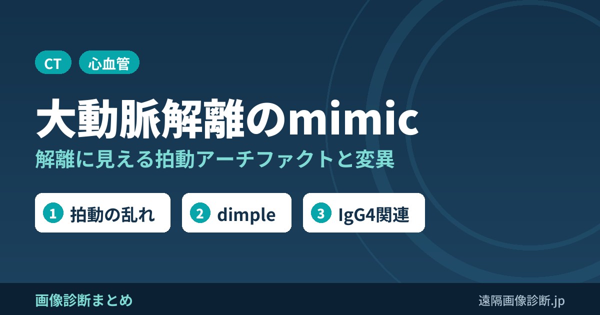 大動脈解離のmimic 解離に見える拍動アーチファクトと変異