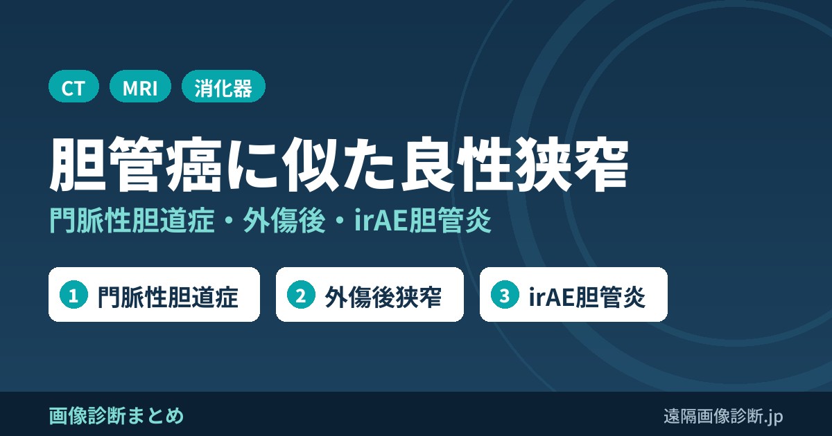 胆管癌に似た良性狭窄 門脈性胆道症・外傷後・irAE胆管炎
