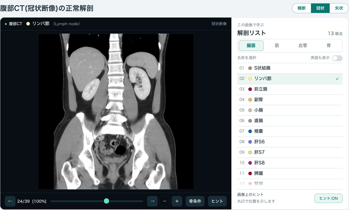 画像診断cafe「腹部CTの正常解剖」の冠状断の画面