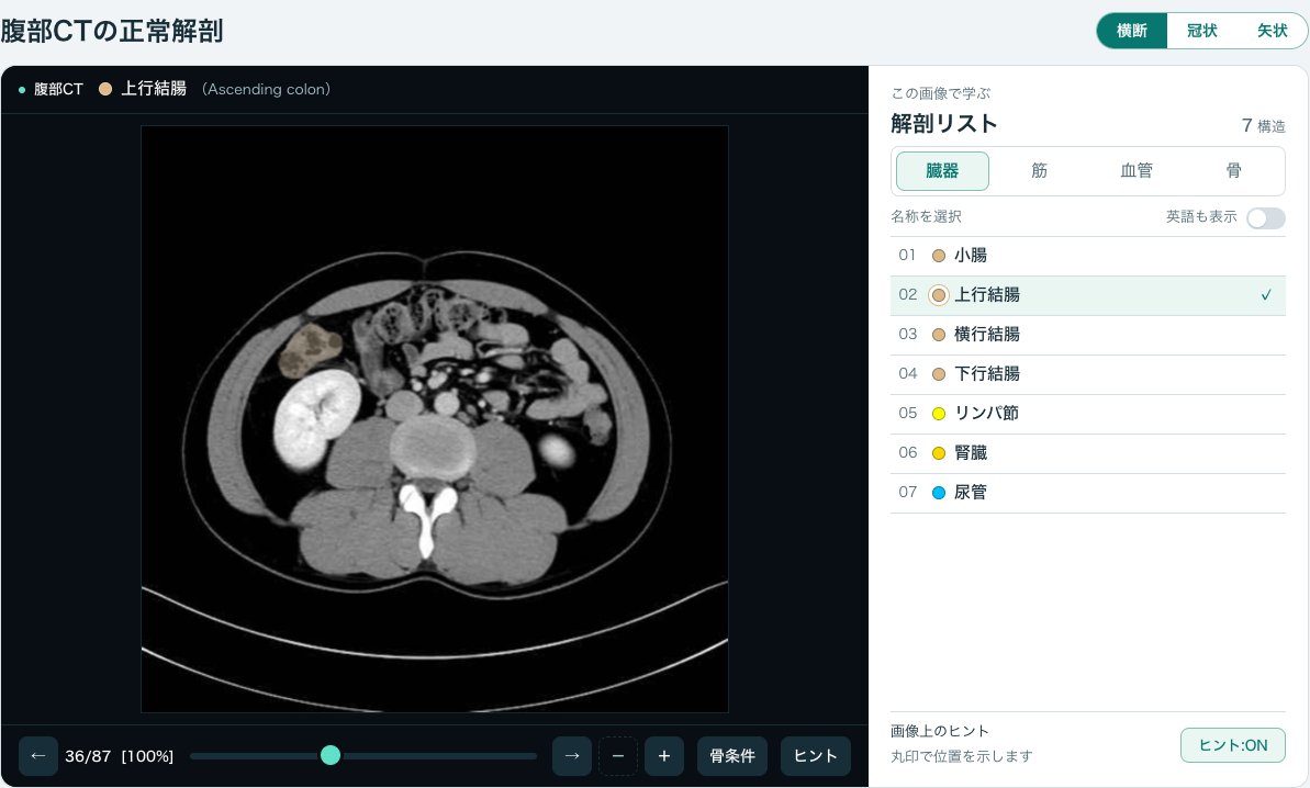 画像診断cafe「腹部CTの正常解剖」の画面(腎門部より下の高さ)