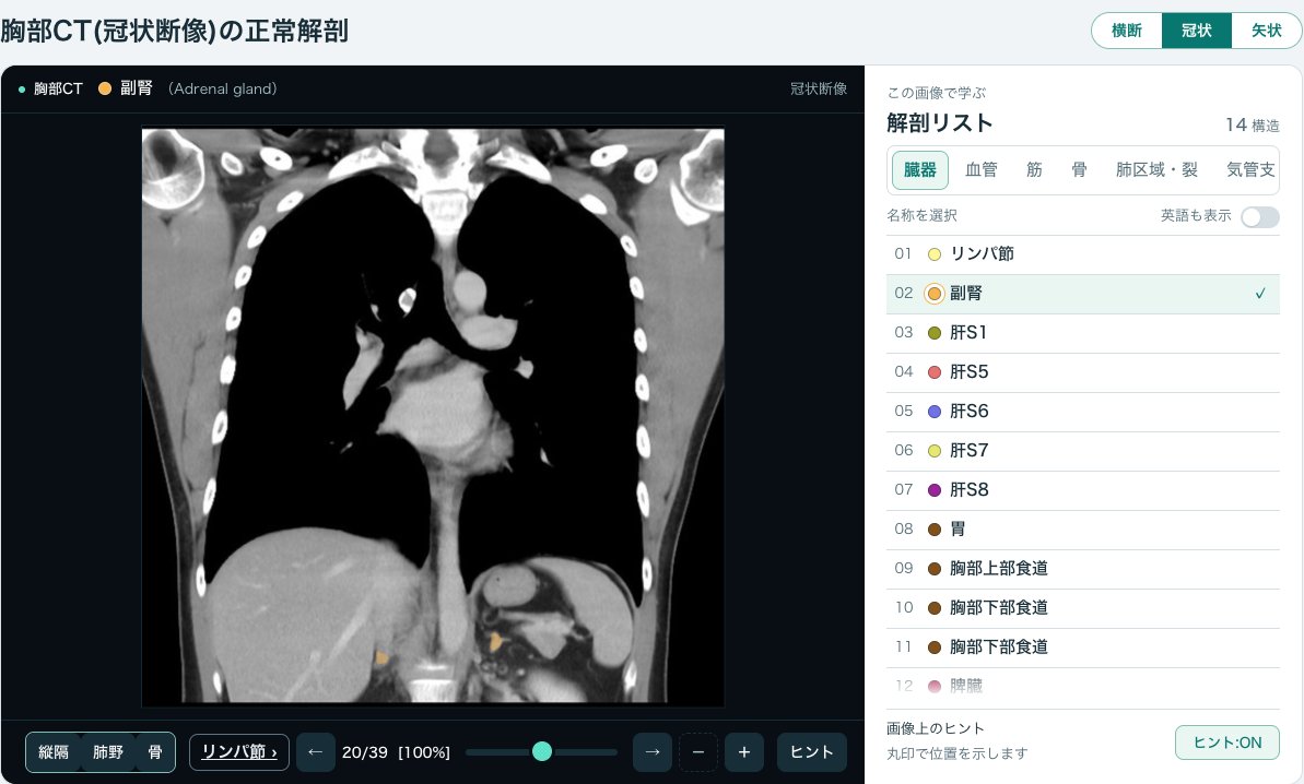 画像診断cafe「胸部CTの正常解剖」の冠状断の画面