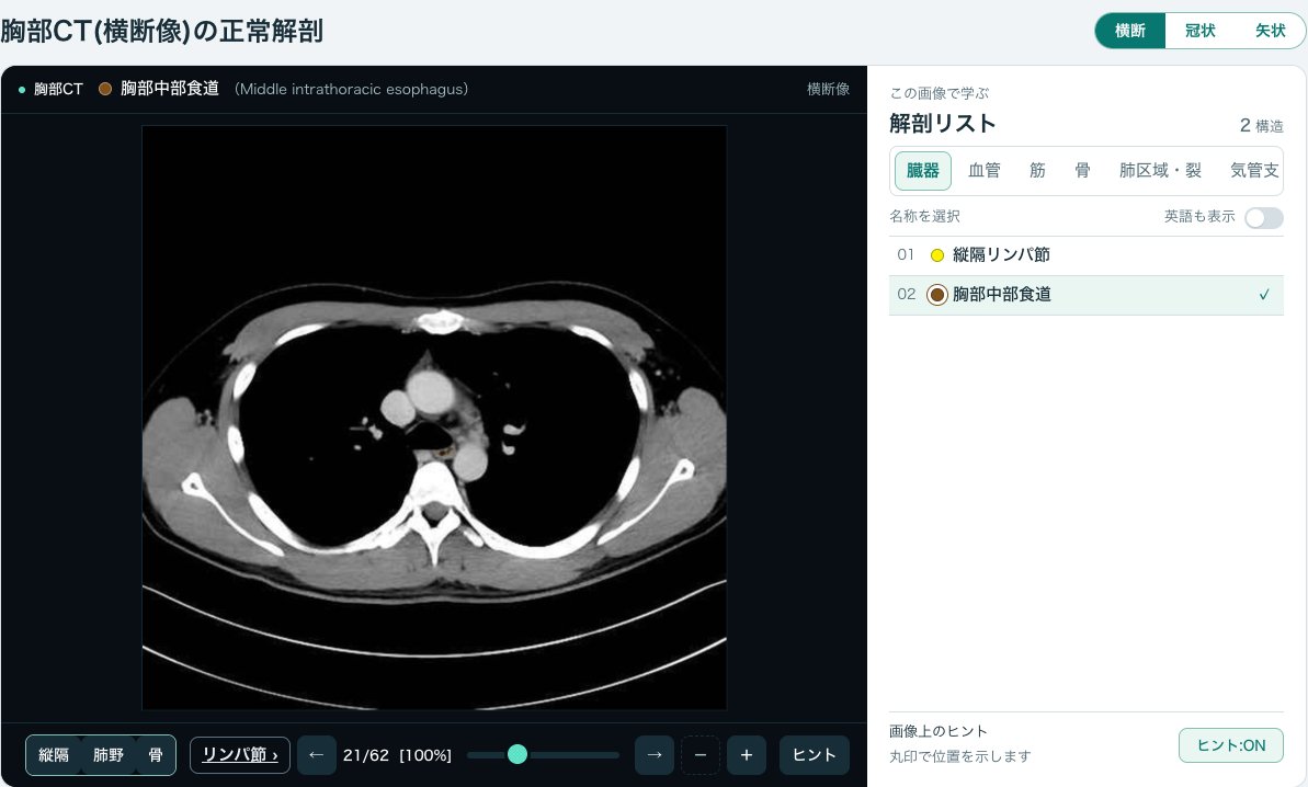画像診断cafe「胸部CTの正常解剖」の画面(縦隔条件・大動脈弓の少し下の高さ)