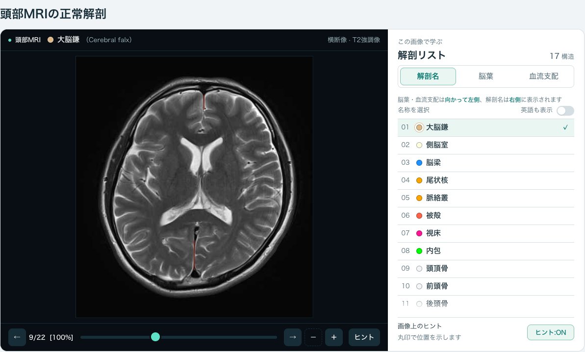 画像診断cafe「頭部MRIの正常解剖」(横断像)の画面