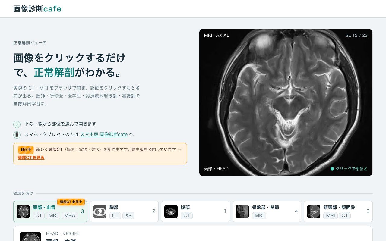 画像診断cafe(medicalimagecafe.com)のトップページ
