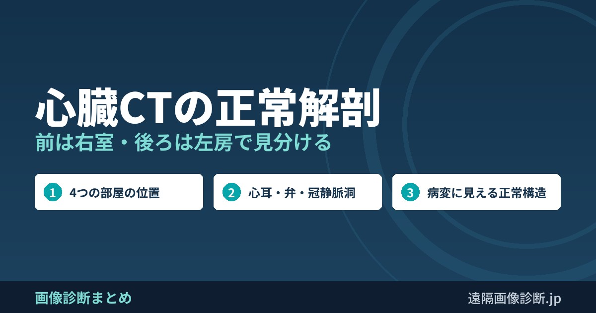心臓CTの正常解剖 前は右室・後ろは左房で見分ける