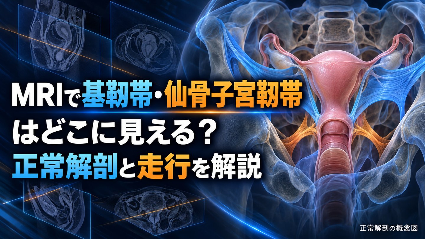 MRIで基靱帯・仙骨子宮靱帯はどこに見える？正常解剖と走行を解説。タイトル入りの骨盤解剖コンセプト画像。