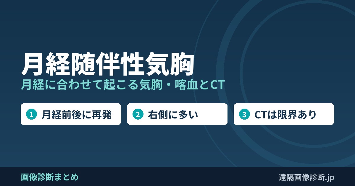 月経随伴性気胸 月経に合わせて起こる気胸・喀血とCT