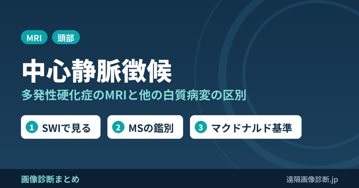 中心静脈徴候 多発性硬化症のMRIと他の白質病変の区別