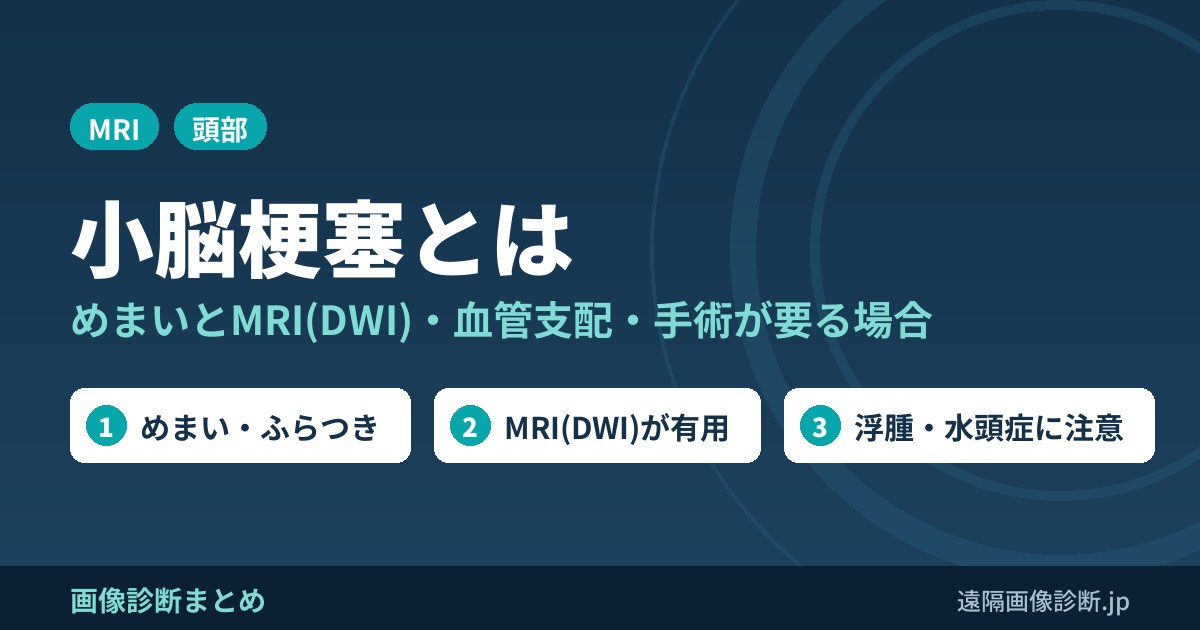 小脳梗塞とは めまいとMRI(DWI)・血管支配・手術が要る場合