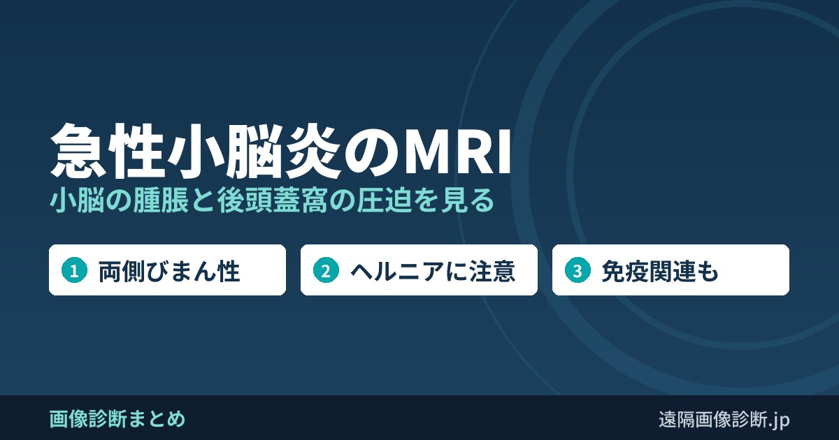 急性小脳炎のMRI 小脳の腫脹と後頭蓋窩の圧迫を見る