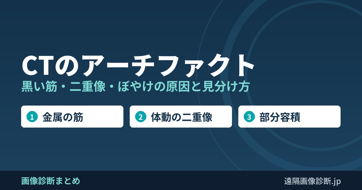 CTのアーチファクト 黒い筋・二重像・ぼやけの原因と見分け方
