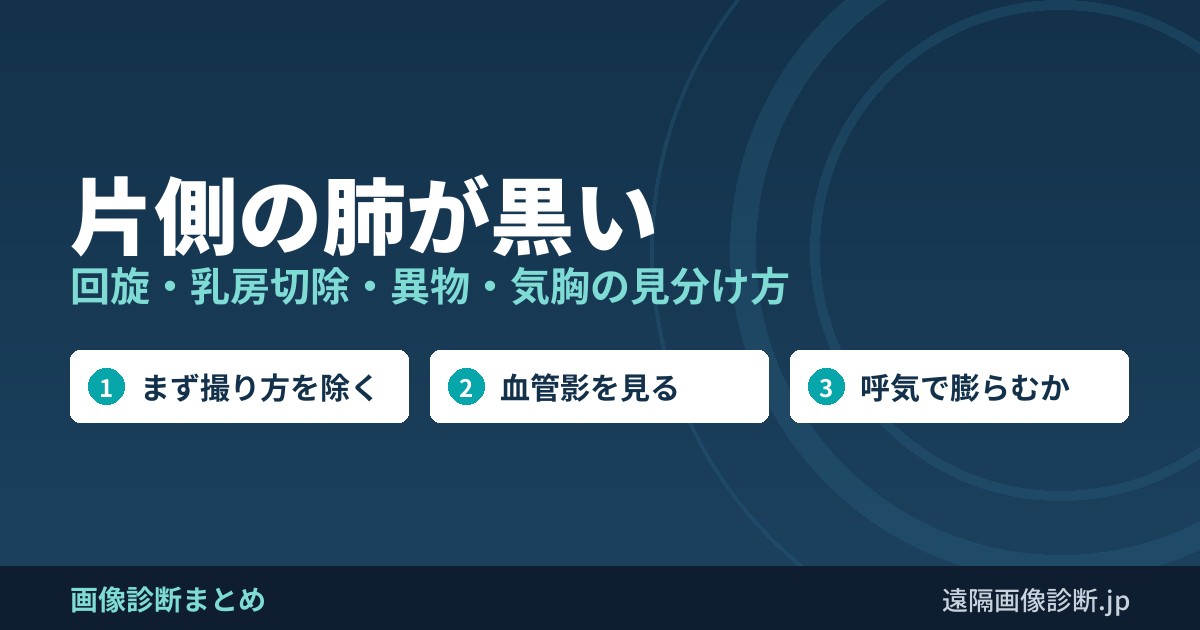 片側の肺が黒い 回旋・乳房切除・異物・気胸の見分け方