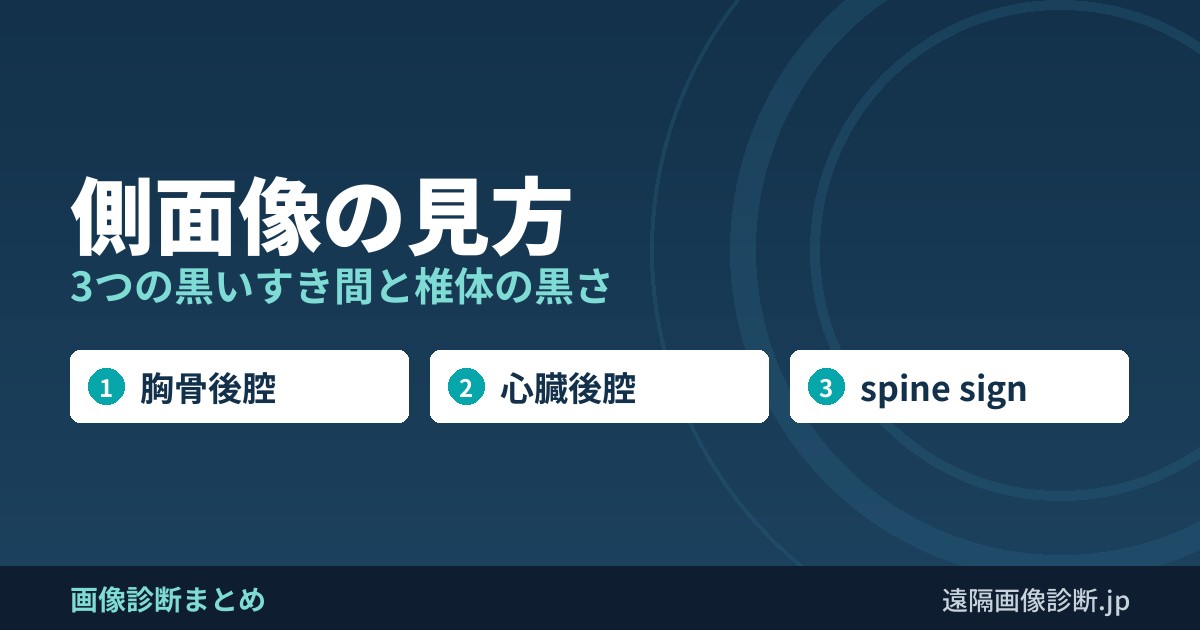 側面像の見方 3つの黒いすき間と椎体の黒さ
