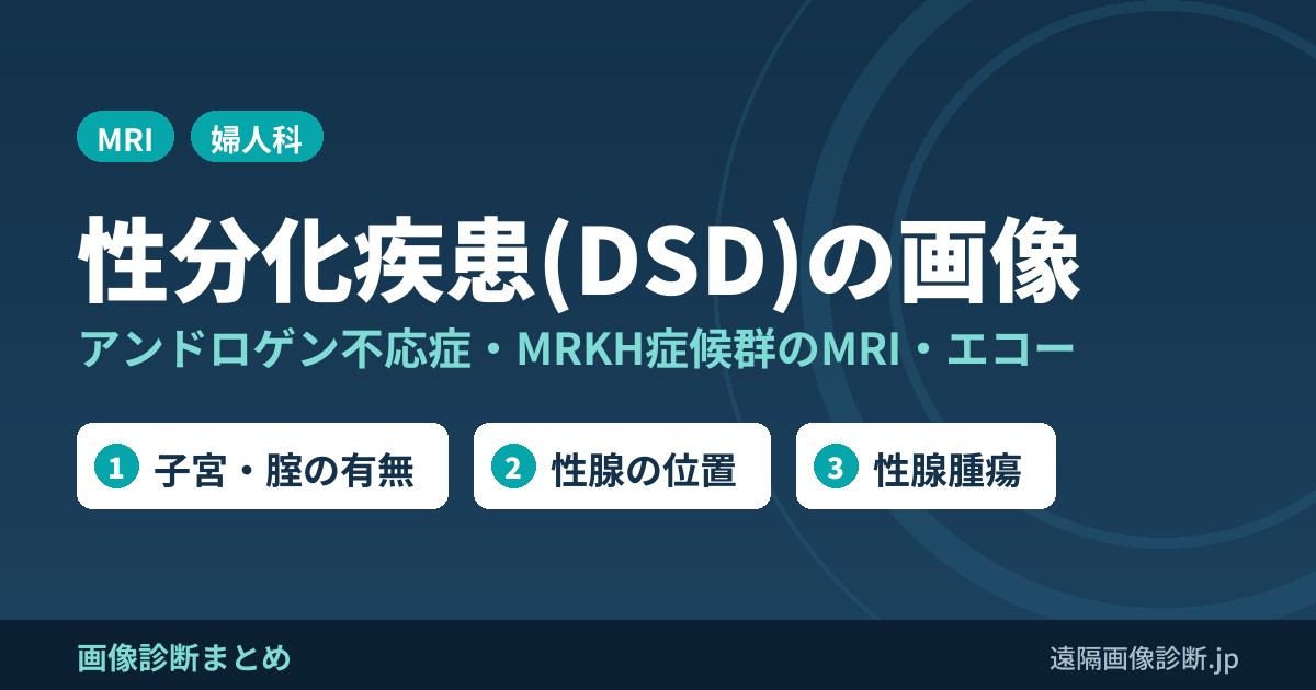 性分化疾患(DSD)の画像 アンドロゲン不応症・MRKH症候群のMRI・エコー