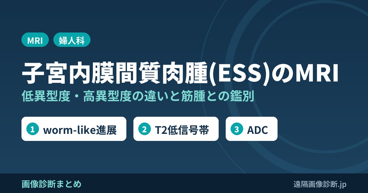 子宮内膜間質肉腫(ESS)のMRI 低異型度・高異型度の違いと筋腫との鑑別