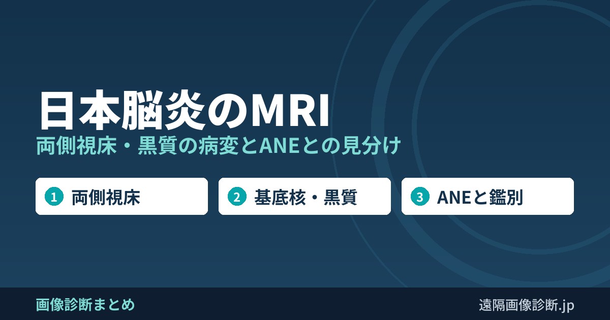 日本脳炎のMRI 両側視床・黒質の病変とANEとの見分け