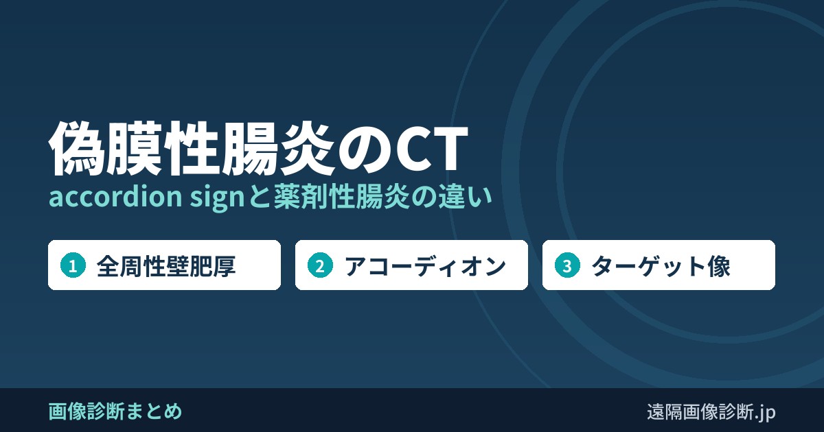 偽膜性腸炎のCT accordion signと薬剤性腸炎の違い