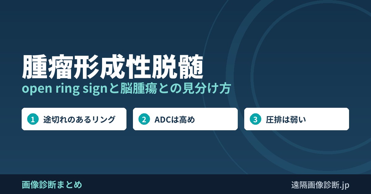 腫瘤形成性脱髄 open ring signと脳腫瘍との見分け方