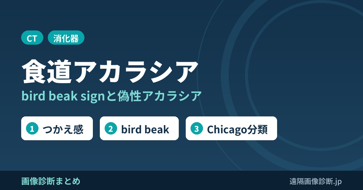 食道アカラシア bird beak signと偽性アカラシア