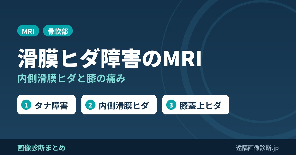 滑膜ヒダ(タナ)障害のMRI画像診断｜内側滑膜ヒダと膝の痛み