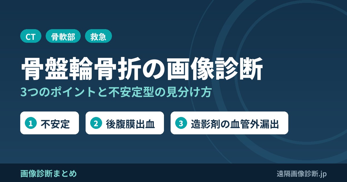 骨盤輪骨折の画像診断の3つのポイント！