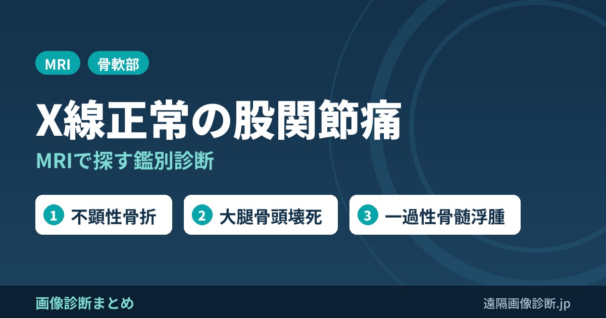 単純X線写真で異常のない股関節痛で考えるべき鑑別診断