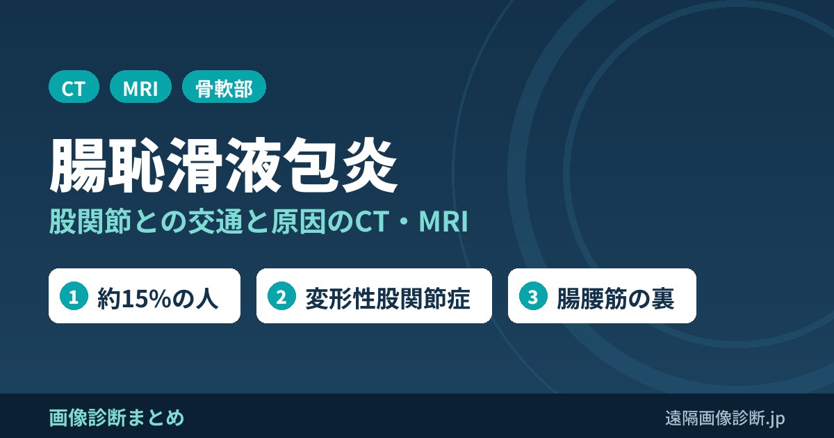 腸恥滑液包炎(腸腰筋滑液包炎)のCT・MRI画像診断｜股関節との交通と原因