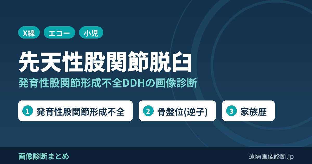 先天性股関節脱臼(congenital dislocation of the hip:CDH)