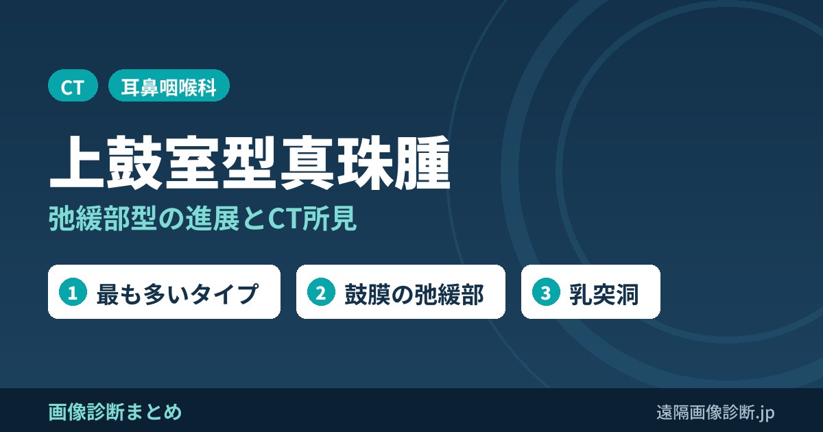 上鼓室型(弛緩部)真珠腫とは？