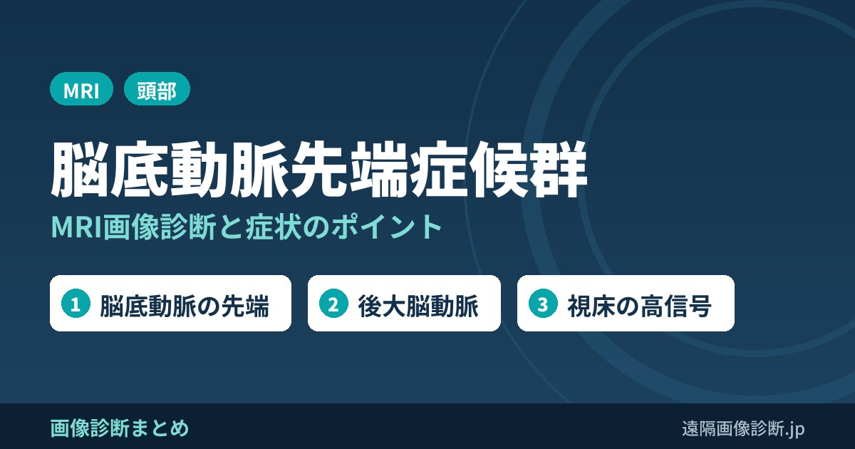脳底動脈先端症候群(top of the basilar syndrome)のMRI画像診断と症状