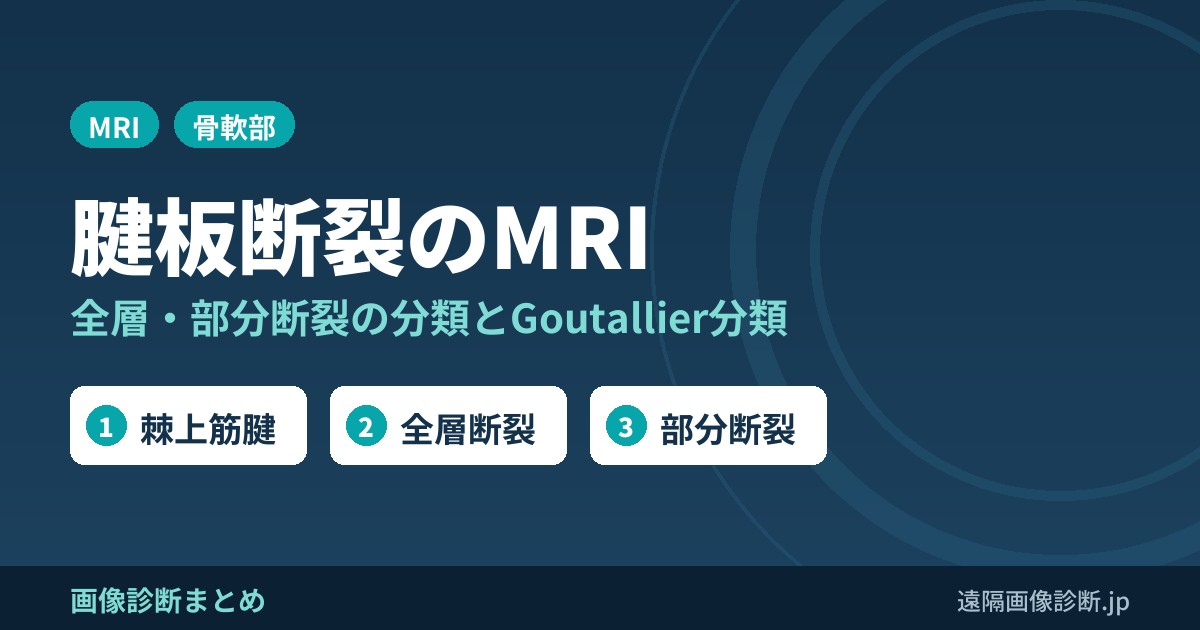 腱板断裂のMRI画像診断のポイント｜全層断裂・部分断裂の分類とGoutallier分類