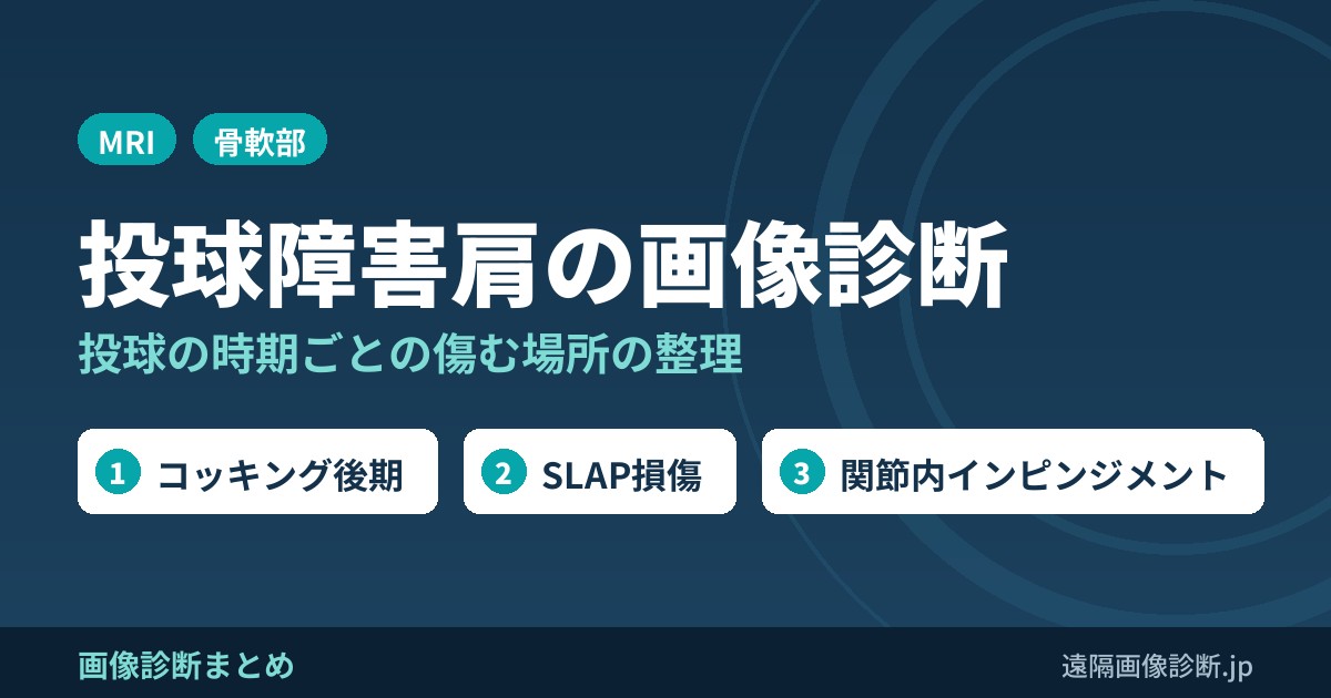 投球障害肩の分類と画像診断