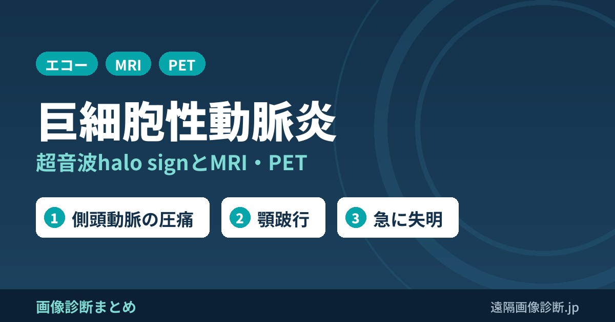 巨細胞性動脈炎(側頭動脈炎)の画像診断｜超音波halo sign・MRI・FDG-PETと症状
