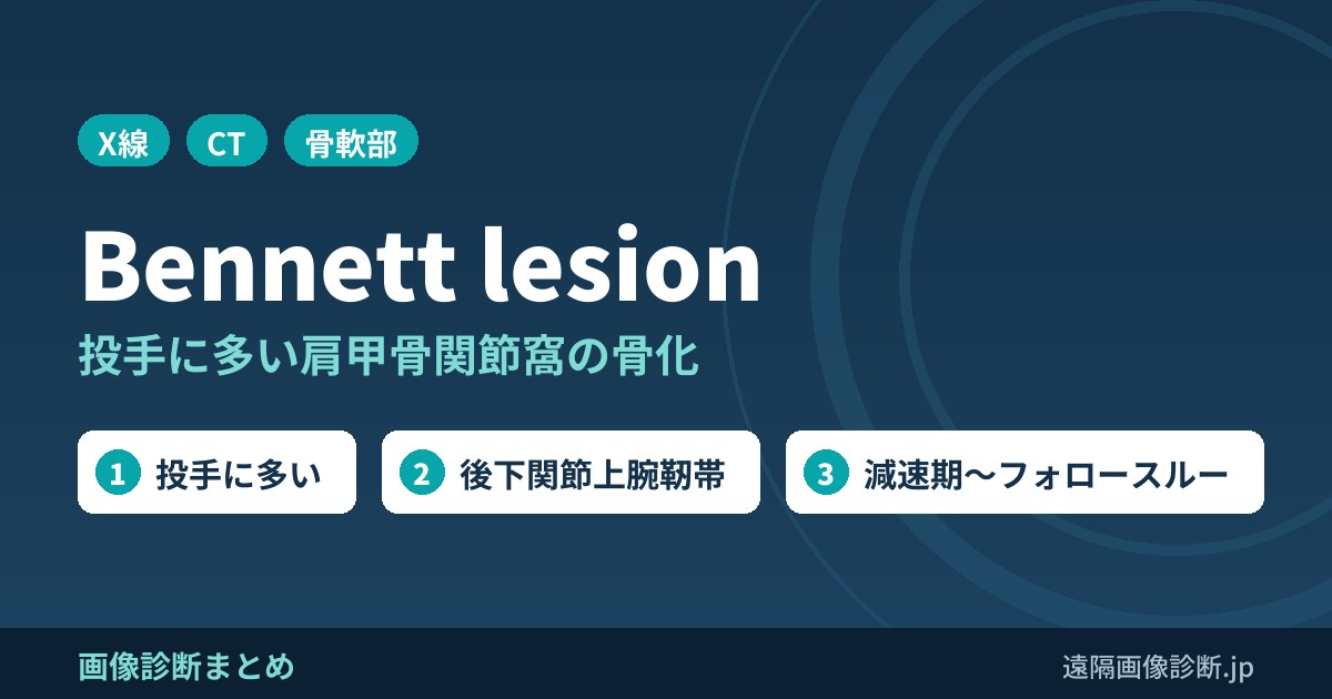 Bennett lesionの画像診断