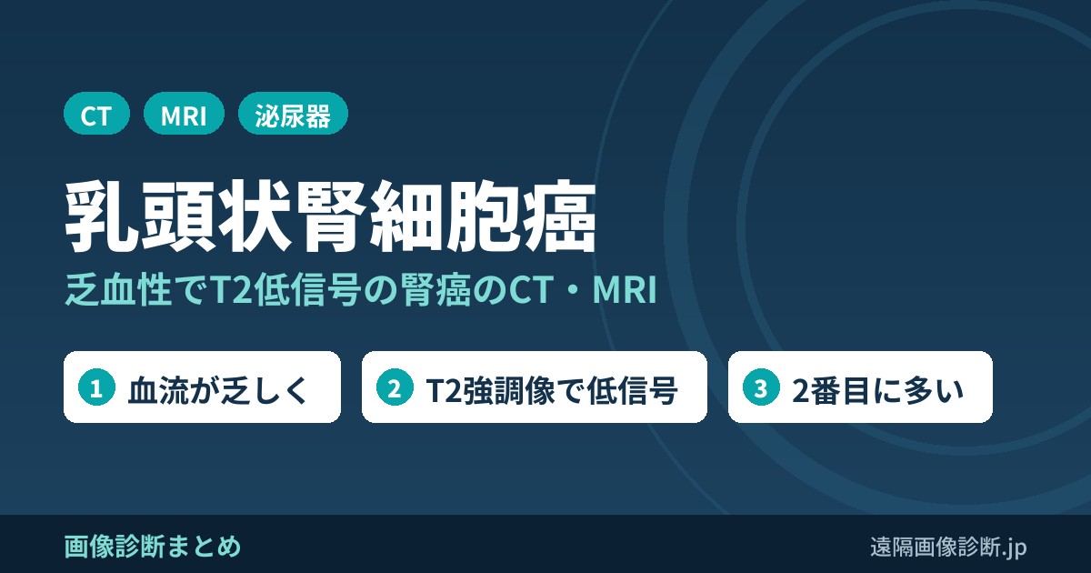 乳頭状腎細胞癌のCT・MRI画像所見｜乏血性・T2低信号と淡明細胞型との違い
