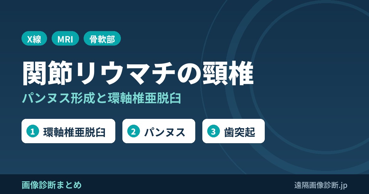 関節リウマチ(RA)における頸椎の変化(パンヌス形成、環軸椎亜脱臼)